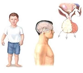 Bebeklerde Büyüme Hormonu Kullanımı ve Faydaları Nelerdir? Bebeklerde Büyüme Hormonu Kullanımı ve Faydaları Nelerdir?