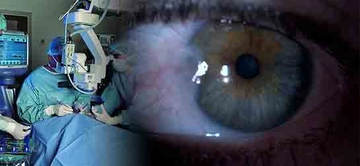 Gözde Et Büyümesi Belirtileri ve Tedavisi